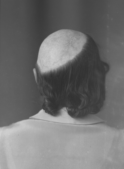 Doktor Hellströms dokumentation
Fröken Larsson
(se även vklba11515)





